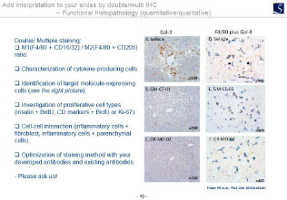 Add interpretation to your slides by double/multi IHC ~ Functional histopathology (quantitative/qualitative)